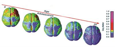 Commentary: The Incidence of Road Traffic Crashes Among Young People Aged 15–20 Years: Differences in Behavior, Lifestyle and Sociodemographic Indices in the Galilee and the Golan